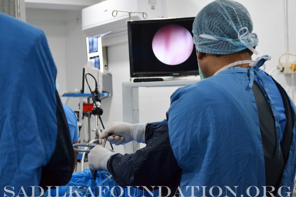 Employing his finesse with an endoscopic camera, Dr. Gupta skillfully searches for the stone based on his prior Xray reading.